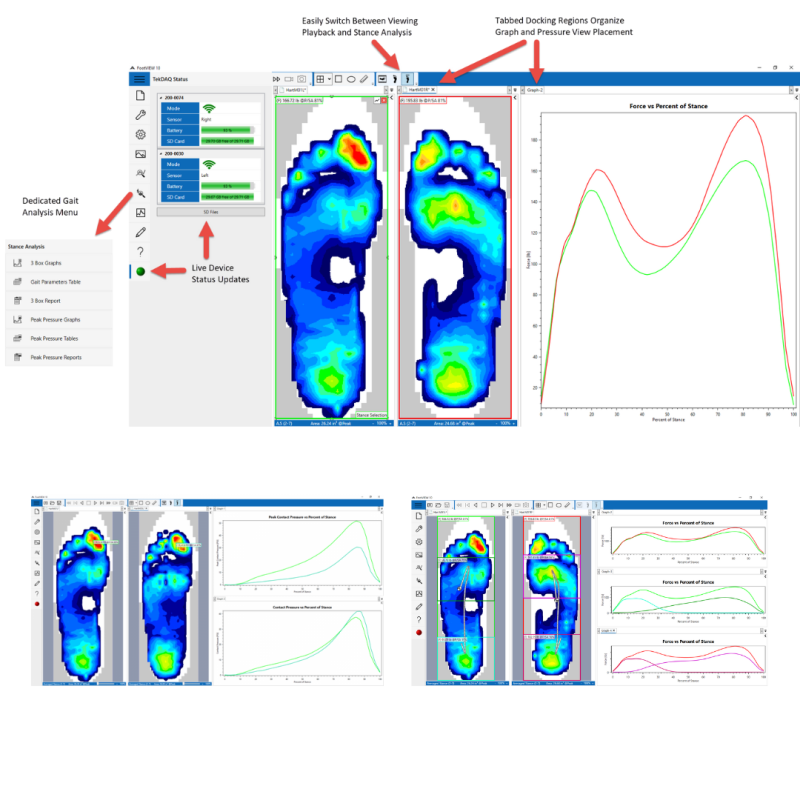 F-Scan™ GO - Système à semelles haute résolution sans fil