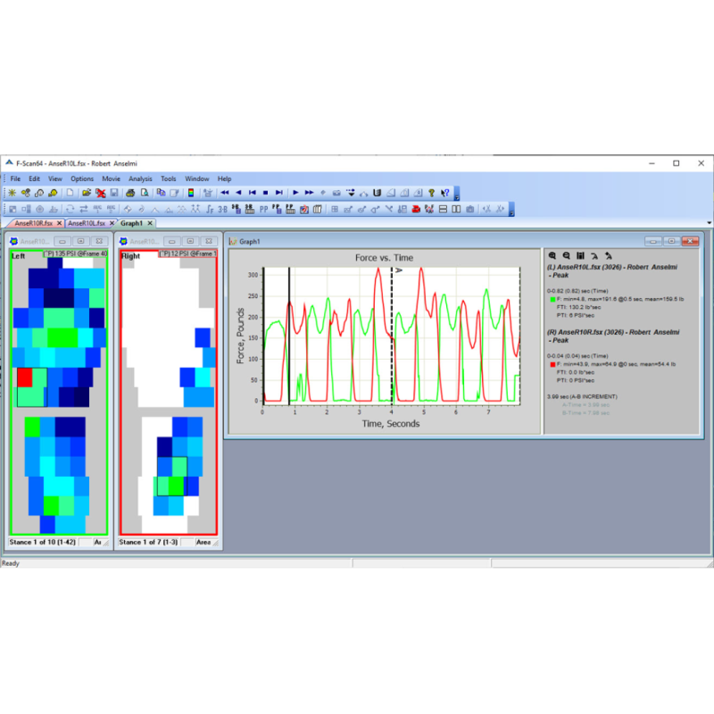 F-Scan64™ - Semelles connectées à  64 capteurs de pression