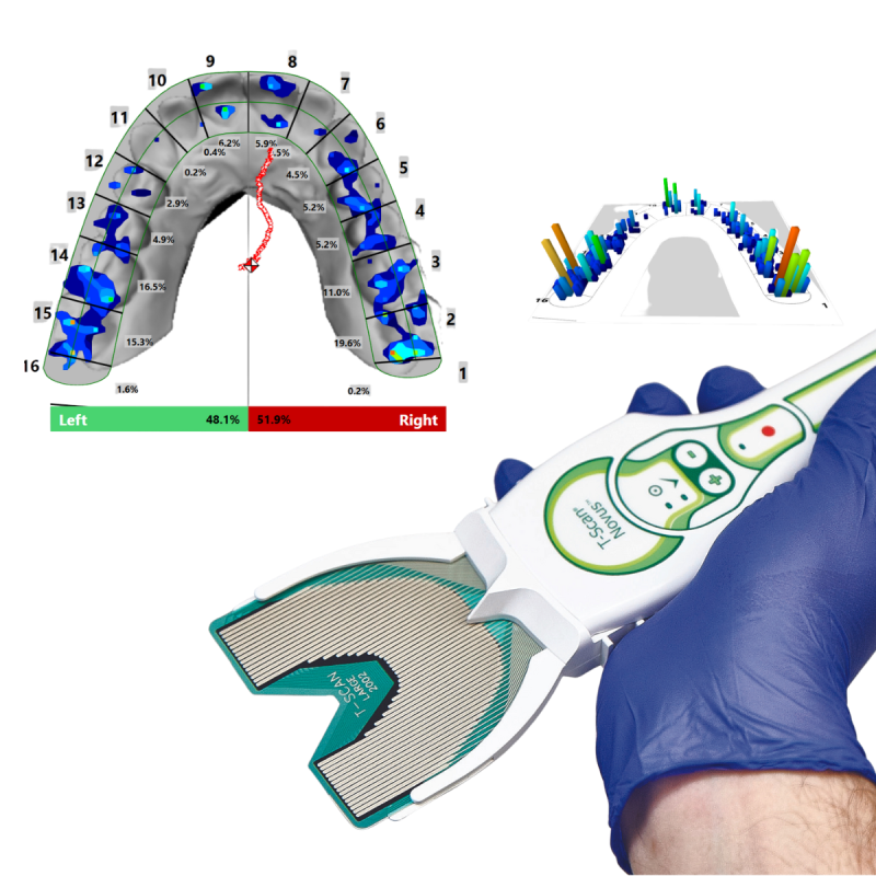 T-Scan® Novus™ - Mesure dynamique des contacts dentaires : forces, localisation, chronologie. Analyse occlusale numérique.